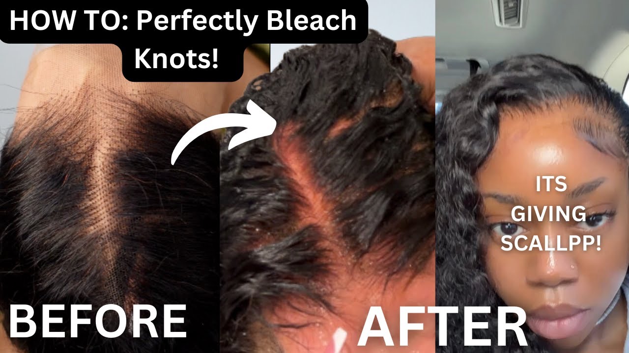 HOW TO: PERFECTLY BLEACH KNOTS! *DETAILED TUTORIAL* + BEGINNER TIPS & TRICKS FT ASTERIA HAIR
